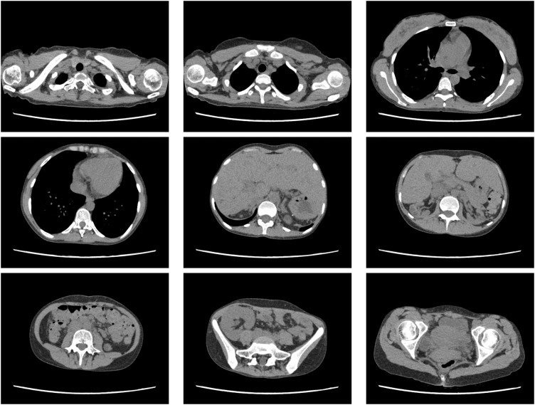 Fig. 4