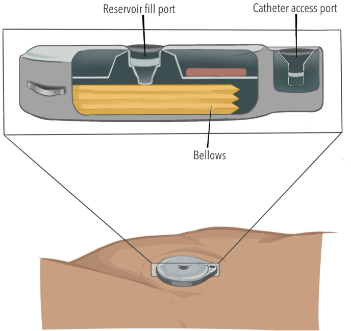 Figure 11