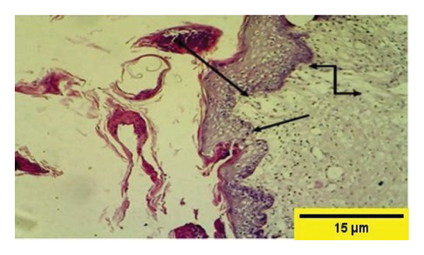 Figure 13