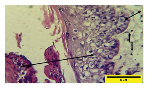 Figure 14