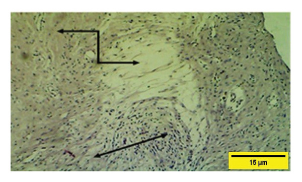 Figure 42