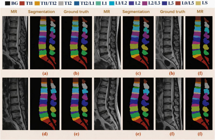 Figure 10