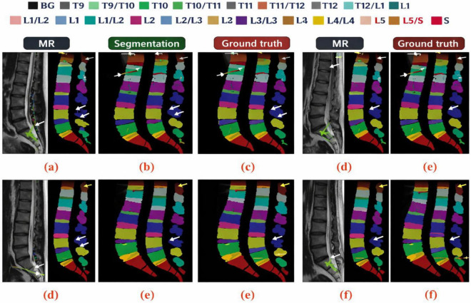 Figure 12
