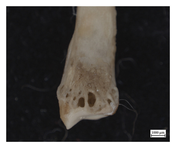Figure 11