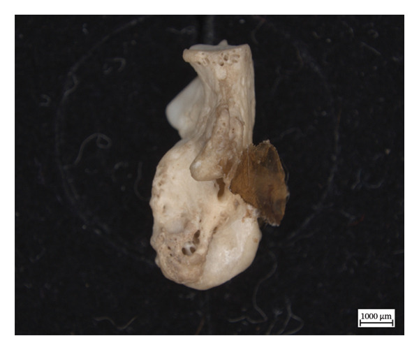 Figure 17