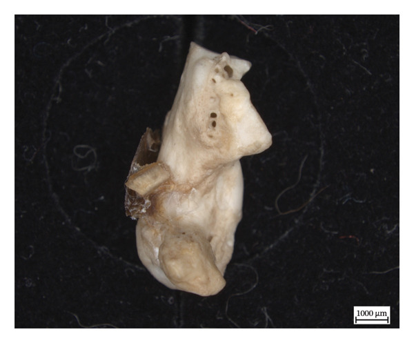 Figure 18