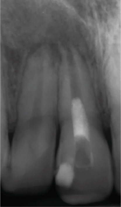 Figure 14
