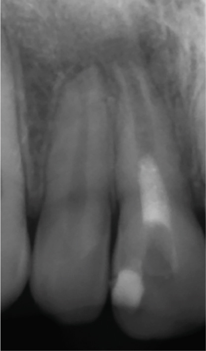Figure 15