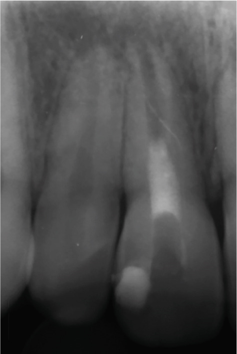 Figure 16