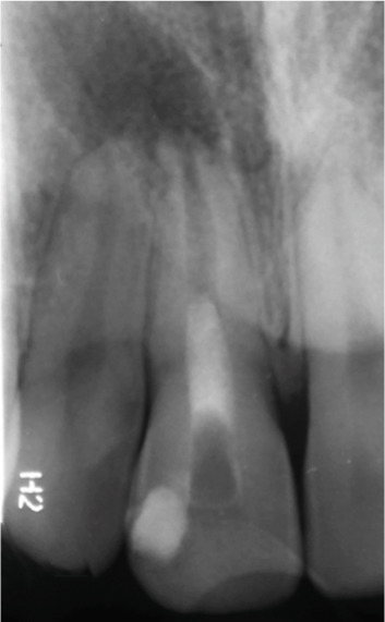 Figure 17