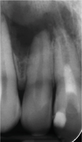 Figure 18
