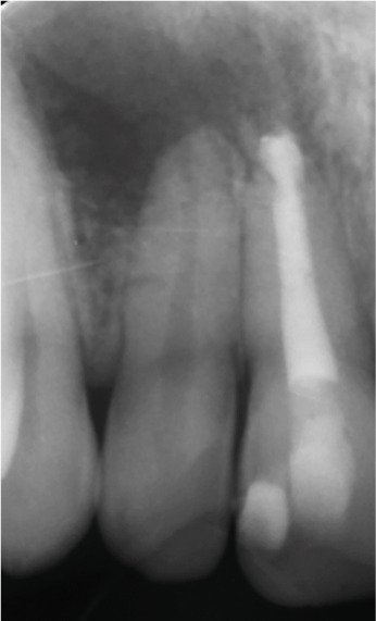 Figure 21