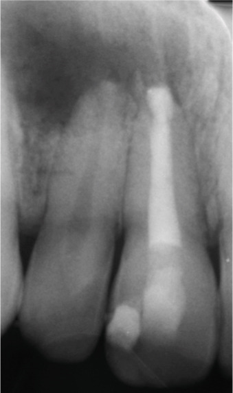 Figure 22