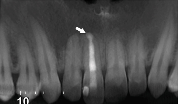 Figure 23
