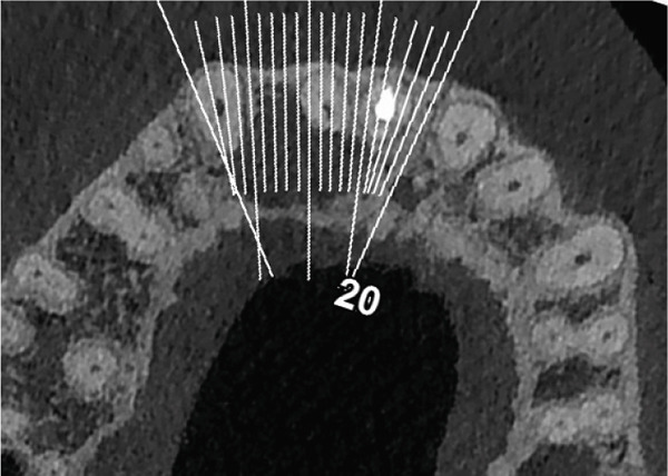 Figure 25