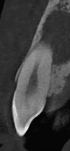 Figure 26