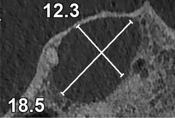 Figure 30