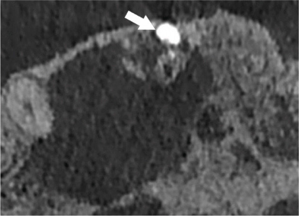 Figure 31