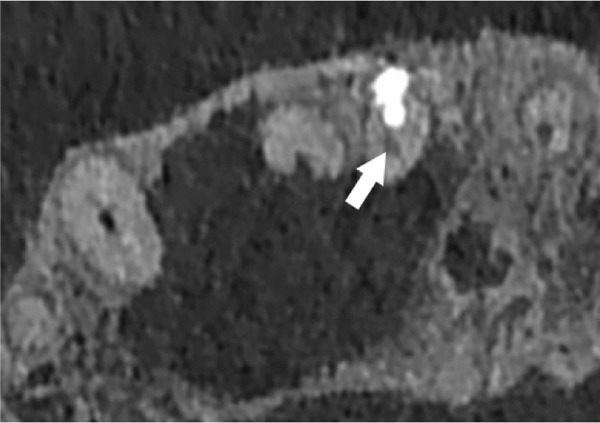 Figure 32