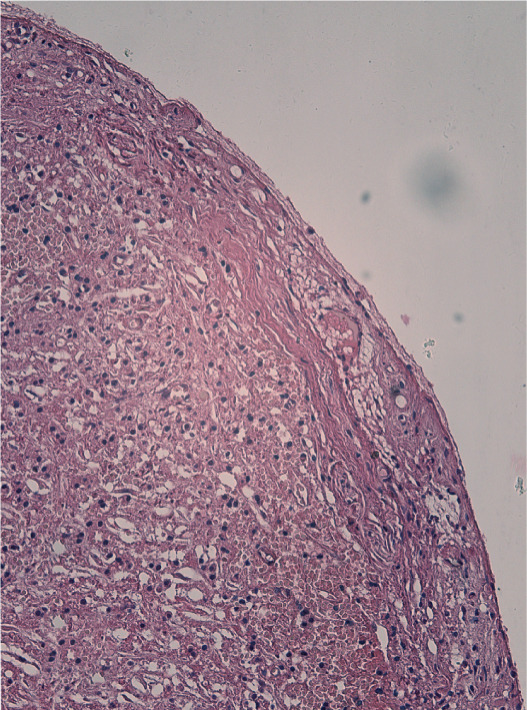 Figure 33