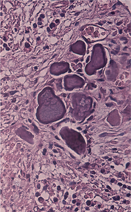 Figure 35