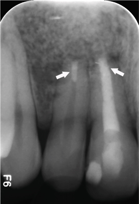Figure 36