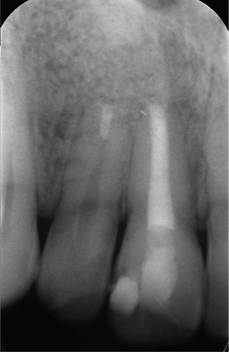 Figure 37