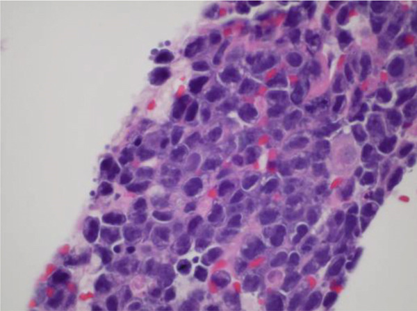 Figure 16