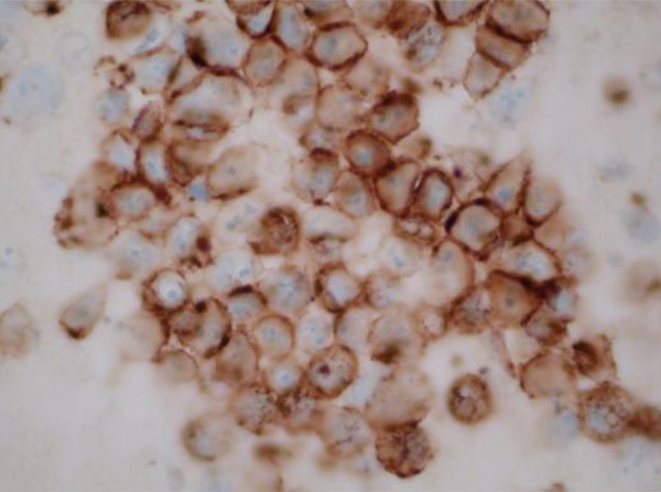 Figure 17