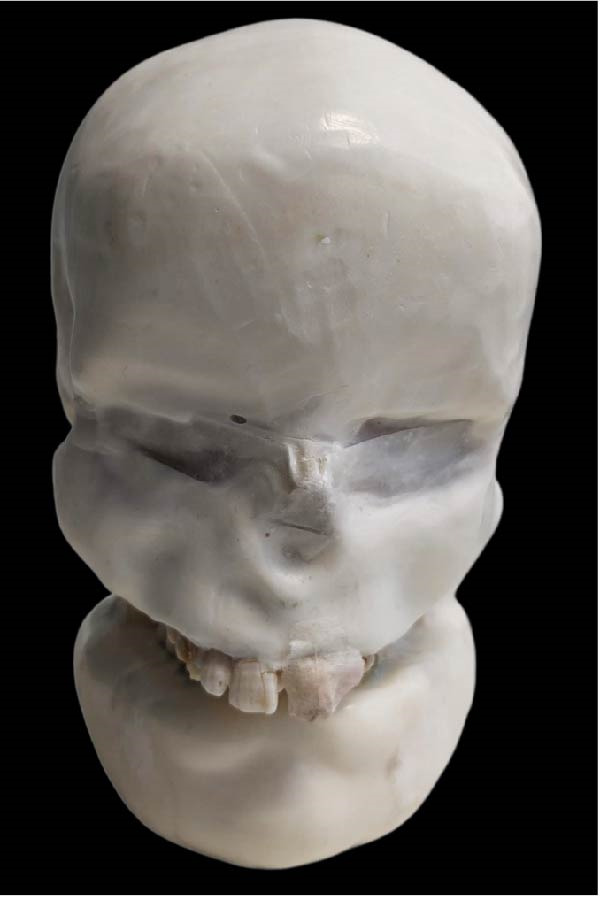 Figure 9