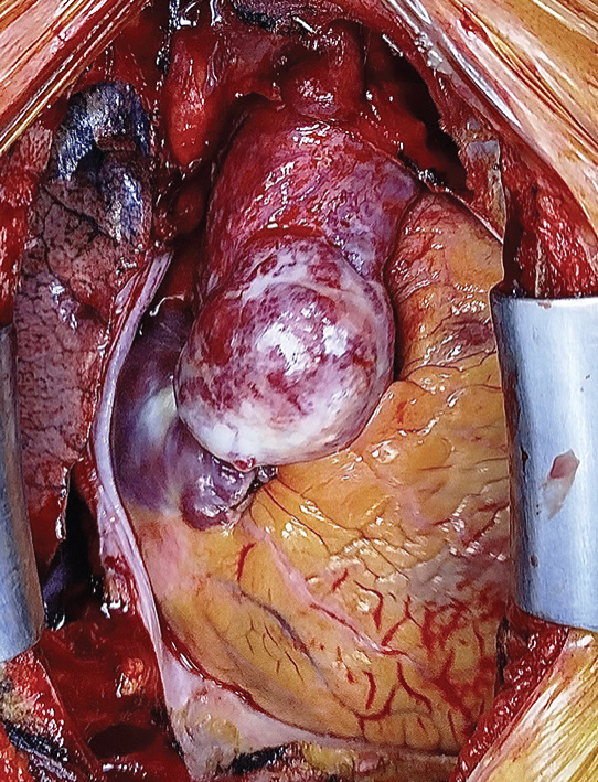 Figure 11