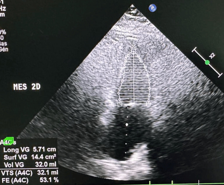 Figure 2