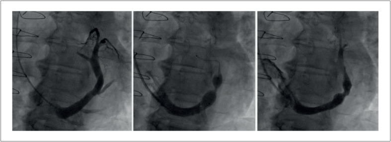 Figure 11