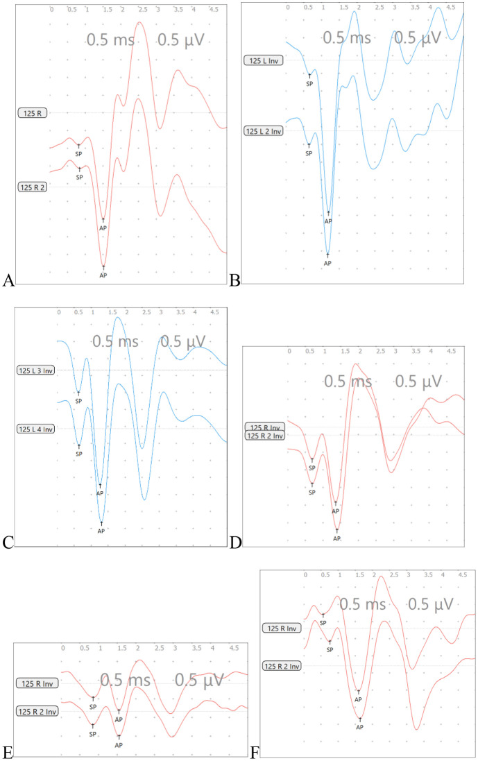 Figure 17