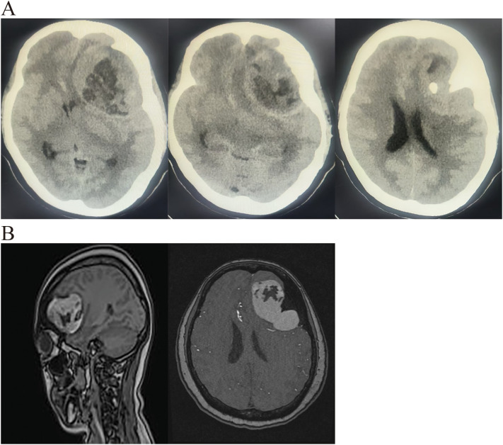 Figure 1