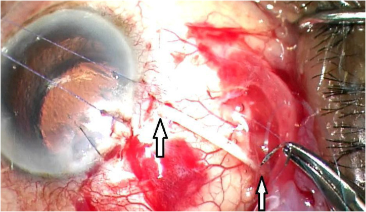 Figure 3