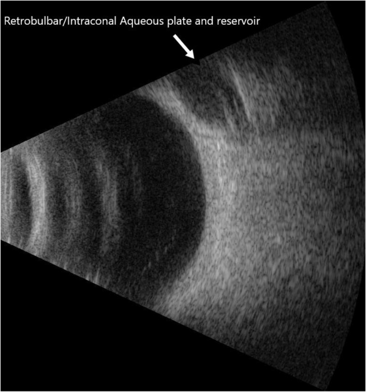 Figure 5