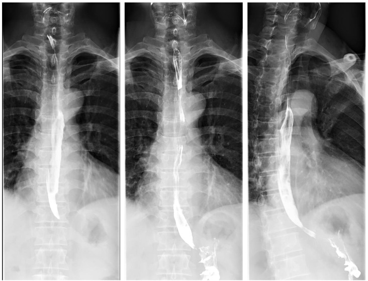 Figure 3