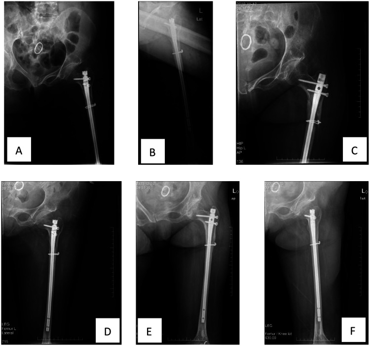 Figure 3