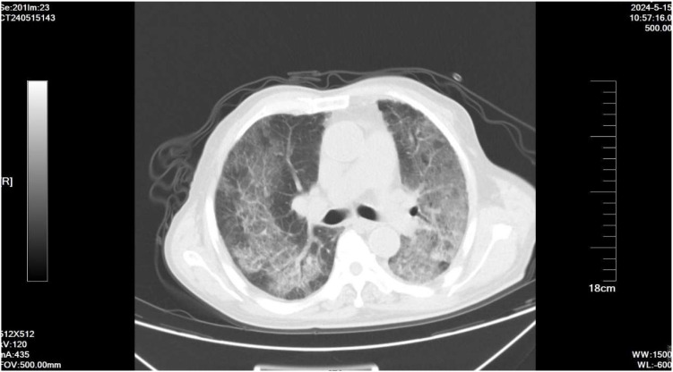 Figure 2