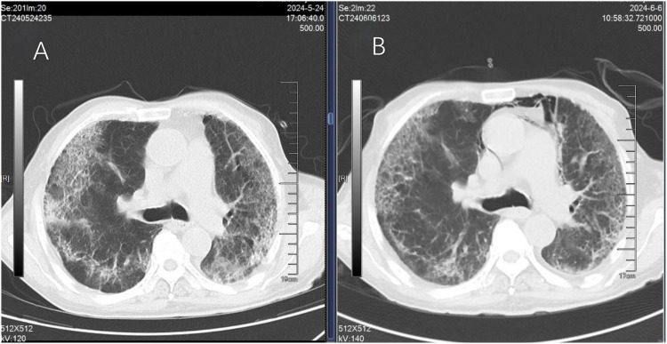 Figure 3
