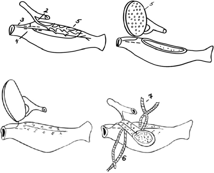 FIGURE 1