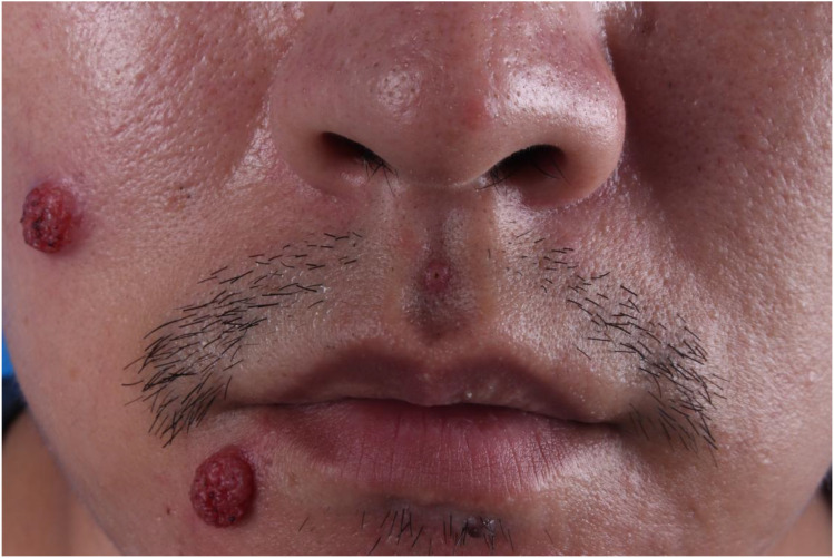 Figure 1