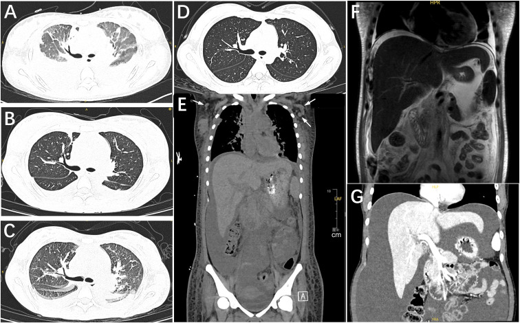 Figure 2