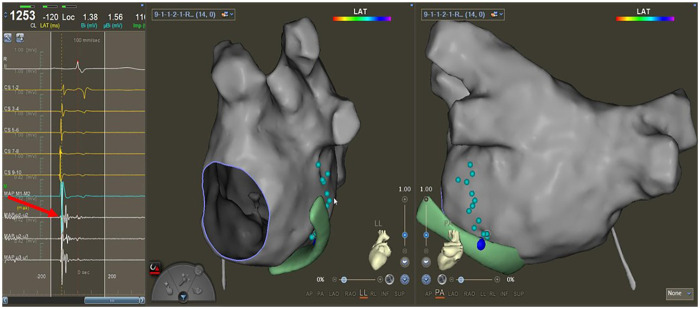 Figure 1
