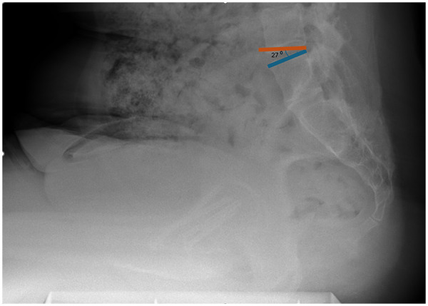 Figure 2