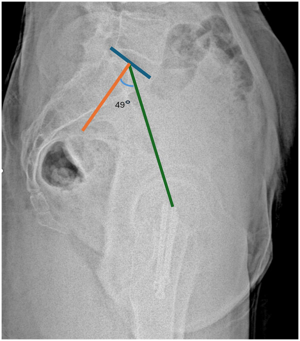 Figure 3