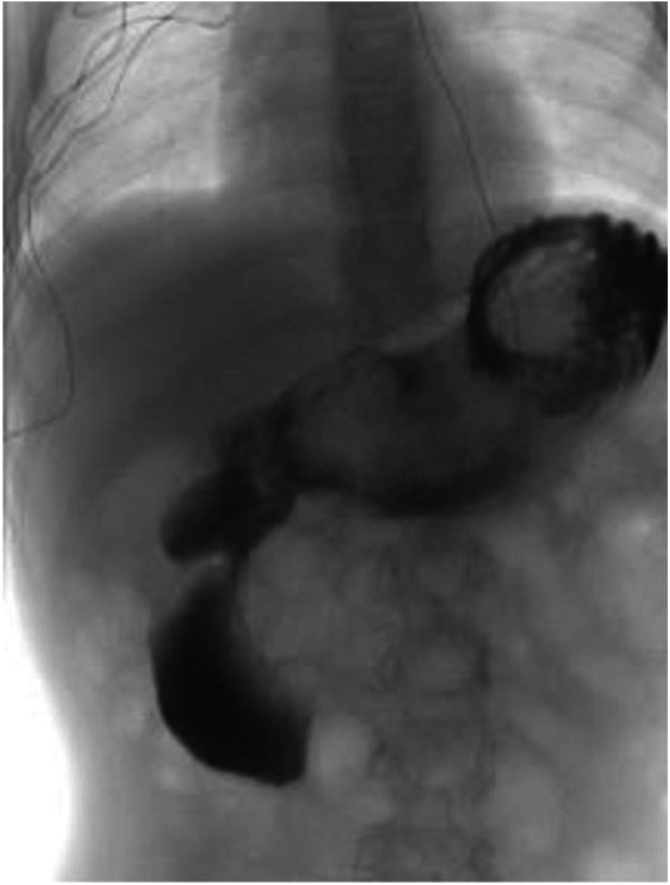 Figure 2
