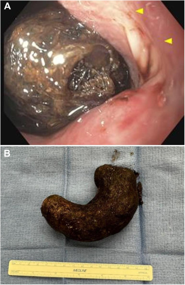 Figure 3