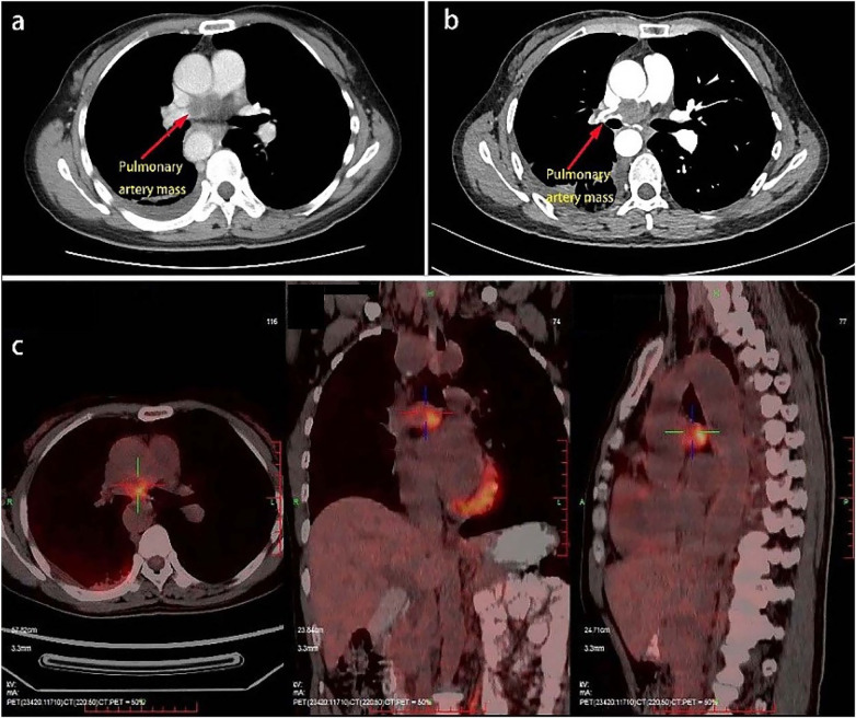 Figure 1